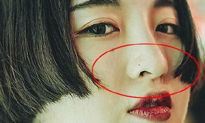 鼻子上长痣会影响运势吗