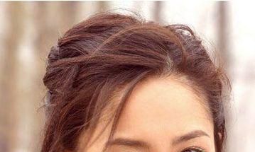 面部有痣的女星