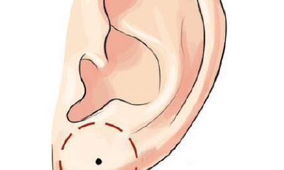 耳朵痣相详解：你知道耳朵上长痣都代表什么吗