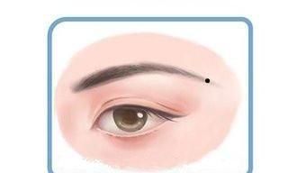 眉尾附近有痣