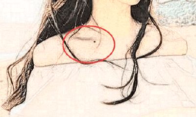 倒霉痣，身上此处长恶痣，厄运连连一定要去掉