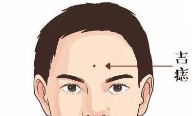 这4个地方长痣，不动产多，车房不愁