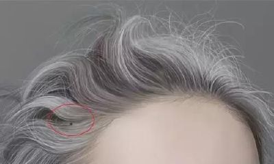 全身四颗“隐痣”，非富即贵，大福之相