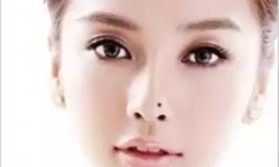 脸上有这3颗痣是大富大贵之痣