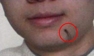 有一种吉痣为痣上长有毛发，这种痣通常人们认为是富贵痣