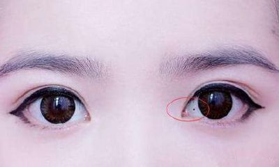 这种痣非常罕见！有这颗痣的人“桃花”旺到令人嫉妒