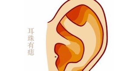 分析耳朵长痣与痣位的好坏之分