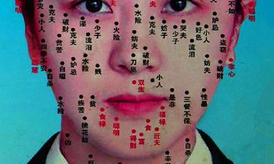 身上长这些痣财运亨通，都是吉痣，可不要傻傻的去点掉