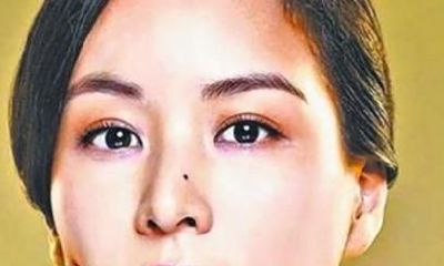 女人鼻子痣相图解，鼻子长痣好不好
