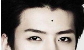 通过痣相如何预测人生吉凶，你的痣是吉是凶