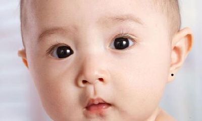 痣相：长有这三个痣的小孩子，注定是大富大贵