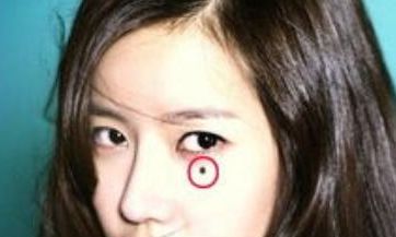 脸上有这些痣，真的敢留吗