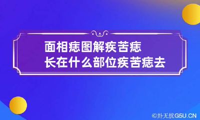 面相痣图解疾苦痣长在什么部位 疾苦痣去掉能破解疾苦吗