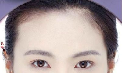 史上最牛全的痣相结合 分析女士脸上痣