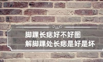 脚踝长痣好不好图解 脚踝处长痣是好是坏