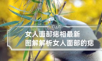 女人面部痣相最新图解解析 女人面部的痣图解大全