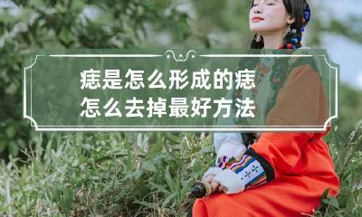 痣是怎么形成的 痣怎么去掉最好方法