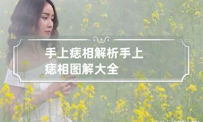 手上痣相解析 手上痣相图解大全