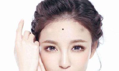 女人额头有痣怎么回事 额头有痣解析