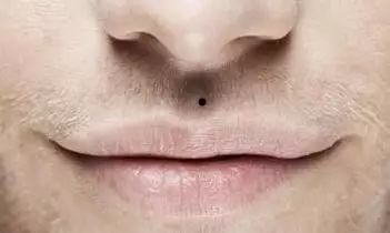 男人人中有痣代表什么 对运势有什么影响