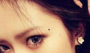 开运痣好不好 开运痣真的能开运吗