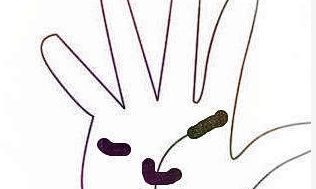 手掌有痣手相面相代表什么