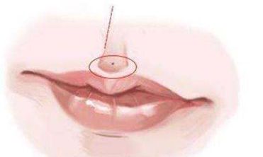 人中有痣的面相好不好