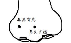 鼻头有痣,鼻子有痣面相
