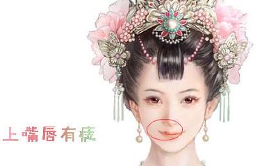 上嘴唇有痣好吗