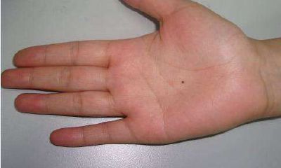 手心有痣的面相