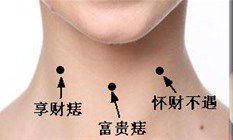 长在脖子上的痣有何寓意