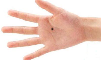 长在手上的痣有何寓意
