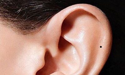 女人脸上7处痣严重破财