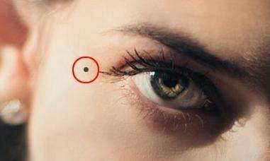 身体哪里长痣预示一生劳碌