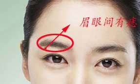 田宅宫长痣会对人有何影响