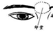 男人印堂有痣图解