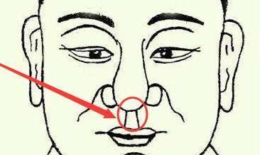 人中旁边有痣代表什么，人中有痣图解