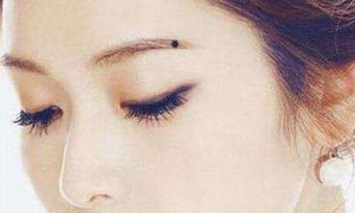 眼眉尾的旅游小心痣