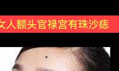 女人额头官禄宫有珠沙痣