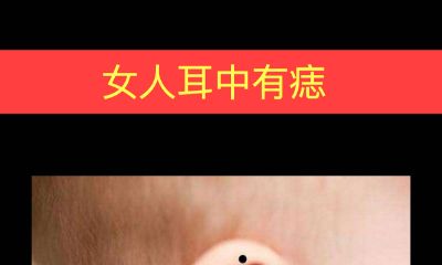 女人耳中有痣