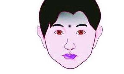从印堂痣相了解一个人的运势