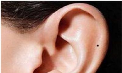 哪些部位有痣的人房产多？