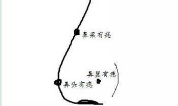 图解鼻子痣相对运势的影响
