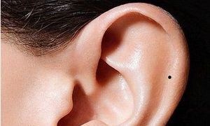 盘点耳朵的活痣