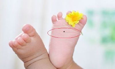 脚底有痣代表什么，从脚底痣相分析个人运途