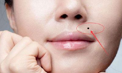 媒婆痣的命运，是好还是坏