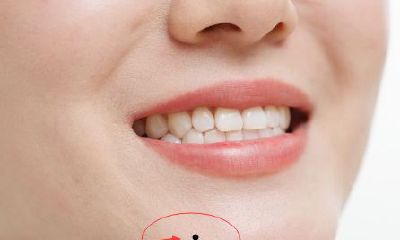 下巴有痣代表什么意思，下巴有痣好不好