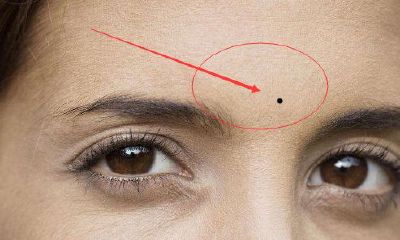 双眉间长痣代表什么，眉间长痣好不好