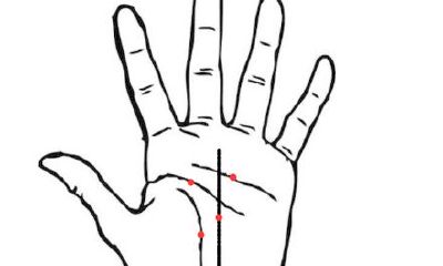 手上有痣图解，手上有痣代表什么