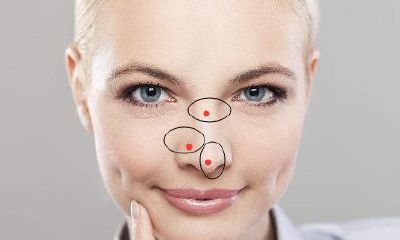 女人鼻子有痣代表什么，鼻子有痣的女人好吗